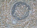 Ferritin light chain Antibody in Immunohistochemistry (Paraffin) (IHC (P))