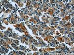 Ferritin light chain Antibody in Immunohistochemistry (Paraffin) (IHC (P))