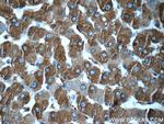 Ferritin light chain Antibody in Immunohistochemistry (Paraffin) (IHC (P))