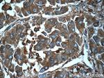 Ferritin light chain Antibody in Immunohistochemistry (Paraffin) (IHC (P))