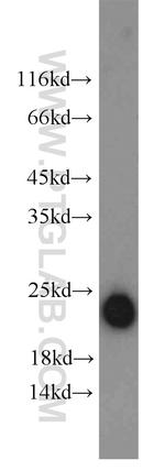 Ferritin light chain Antibody in Western Blot (WB)