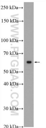 PRPF4 Antibody in Western Blot (WB)