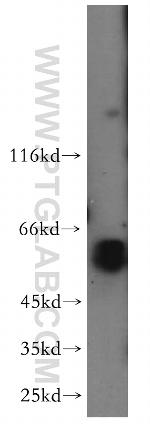 PRPF4 Antibody in Western Blot (WB)