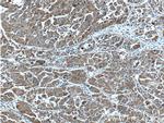 AKR7A2 Antibody in Immunohistochemistry (Paraffin) (IHC (P))