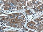 AKR7A2 Antibody in Immunohistochemistry (Paraffin) (IHC (P))