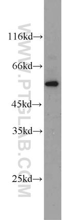 MYOT Antibody in Western Blot (WB)