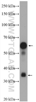 MYOT Antibody in Western Blot (WB)