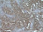 UBE2B Antibody in Immunohistochemistry (Paraffin) (IHC (P))