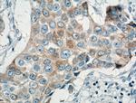 MGP Antibody in Immunohistochemistry (Paraffin) (IHC (P))