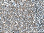 RAC2 Antibody in Immunohistochemistry (Paraffin) (IHC (P))