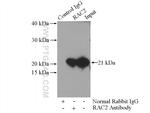 RAC2 Antibody in Immunoprecipitation (IP)