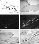 Cytokeratin 15 Antibody in Immunohistochemistry (IHC)