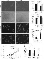 Cytokeratin 15 Antibody in Immunocytochemistry (ICC/IF)