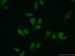 VCP Antibody in Immunocytochemistry (ICC/IF)