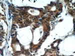 VCP Antibody in Immunohistochemistry (Paraffin) (IHC (P))