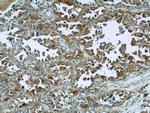 VCP Antibody in Immunohistochemistry (Paraffin) (IHC (P))