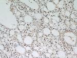 VCP Antibody in Immunohistochemistry (Paraffin) (IHC (P))