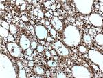 VCP Antibody in Immunohistochemistry (Paraffin) (IHC (P))