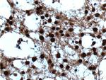 VCP Antibody in Immunohistochemistry (Paraffin) (IHC (P))