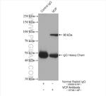 VCP Antibody in Immunoprecipitation (IP)