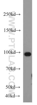 VCP Antibody in Western Blot (WB)