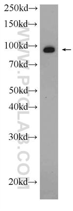 VCP Antibody in Western Blot (WB)