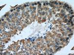 RTN4/NOGO Antibody in Immunohistochemistry (Paraffin) (IHC (P))