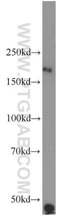 RTN4/NOGO Antibody in Western Blot (WB)