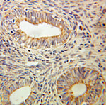 CD59 Antibody in Immunohistochemistry (Paraffin) (IHC (P))