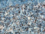 CD59 Antibody in Immunohistochemistry (Paraffin) (IHC (P))