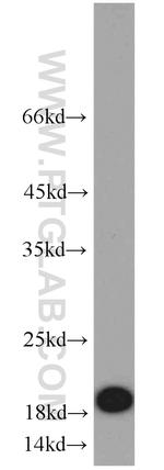 CD59 Antibody in Western Blot (WB)