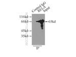 p65/RELA Antibody in Immunoprecipitation (IP)
