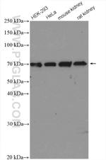 p65/RELA Antibody in Western Blot (WB)