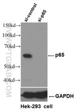 p65/RELA Antibody in Western Blot (WB)