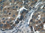 p65/RELA Antibody in Immunohistochemistry (Paraffin) (IHC (P))