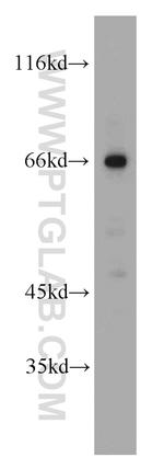 p65/RELA Antibody in Western Blot (WB)