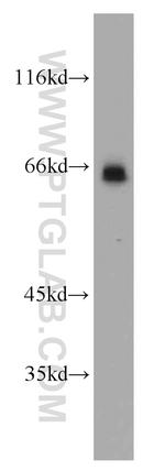 p65/RELA Antibody in Western Blot (WB)