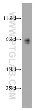 p65/RELA Antibody in Western Blot (WB)