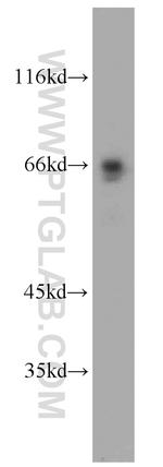 p65/RELA Antibody in Western Blot (WB)