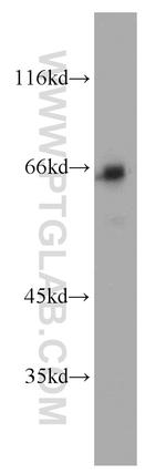 p65/RELA Antibody in Western Blot (WB)