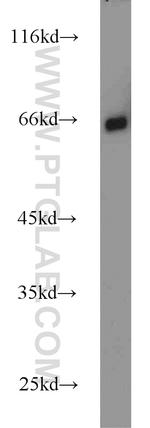 p65/RELA Antibody in Western Blot (WB)