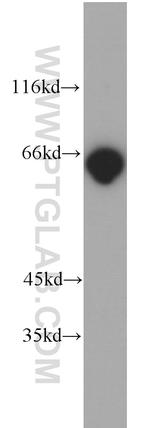 p65/RELA Antibody in Western Blot (WB)