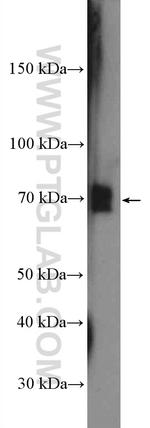 p65/RELA Antibody in Western Blot (WB)