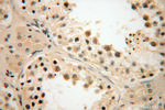 LKB1 Antibody in Immunohistochemistry (Paraffin) (IHC (P))