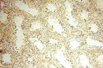 LKB1 Antibody in Immunohistochemistry (Paraffin) (IHC (P))