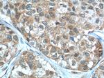 LKB1 Antibody in Immunohistochemistry (Paraffin) (IHC (P))