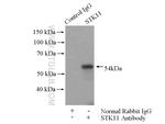 LKB1 Antibody in Immunoprecipitation (IP)