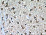 DARPP32 Antibody in Immunohistochemistry (Paraffin) (IHC (P))