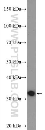 DARPP32 Antibody in Western Blot (WB)