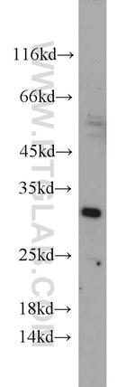 DARPP32 Antibody in Western Blot (WB)